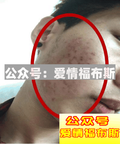 男人的脸部皮肤怎么保养？用什么保养？第3张